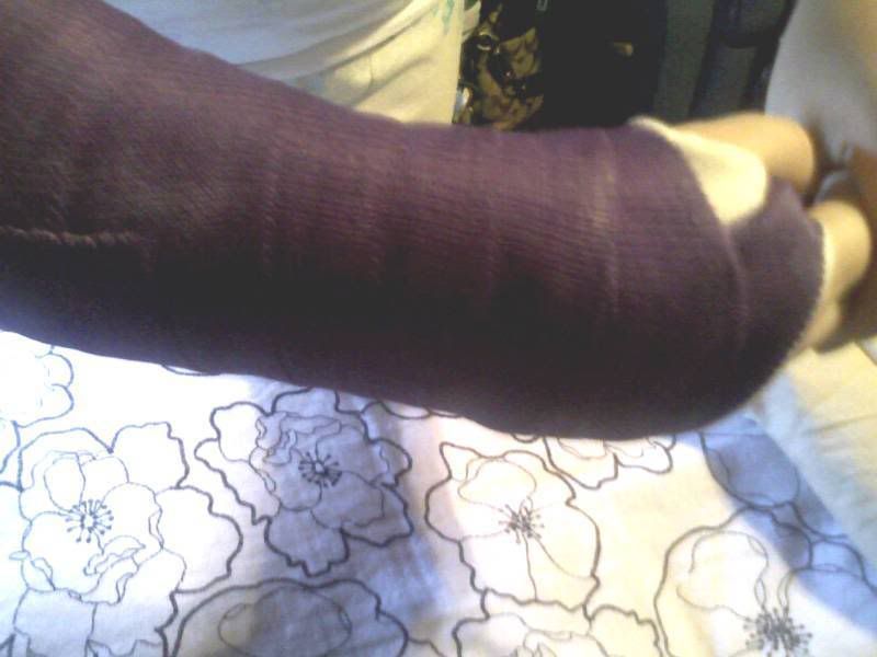 arm.jpg