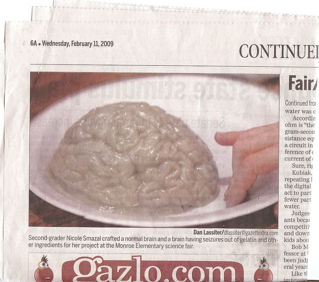brain.jpg